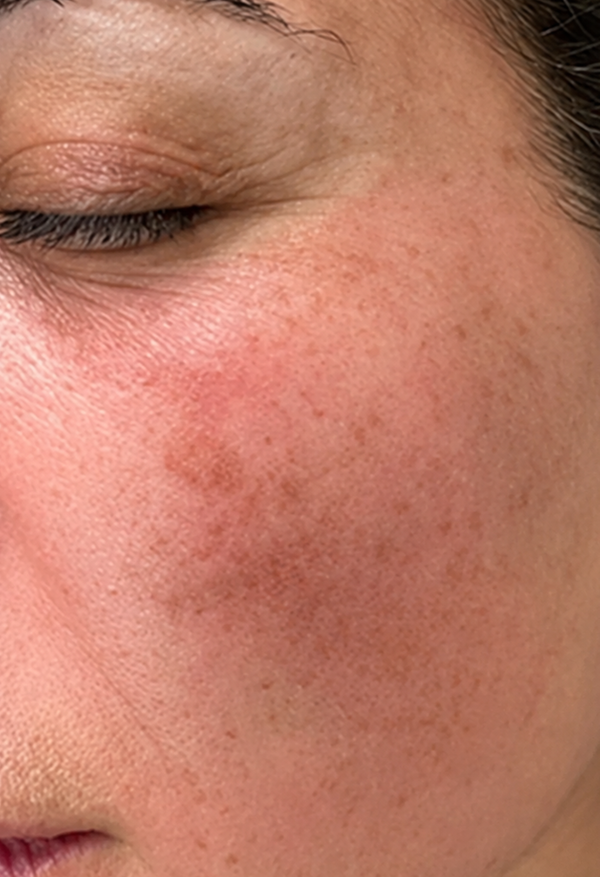 Dark spots before