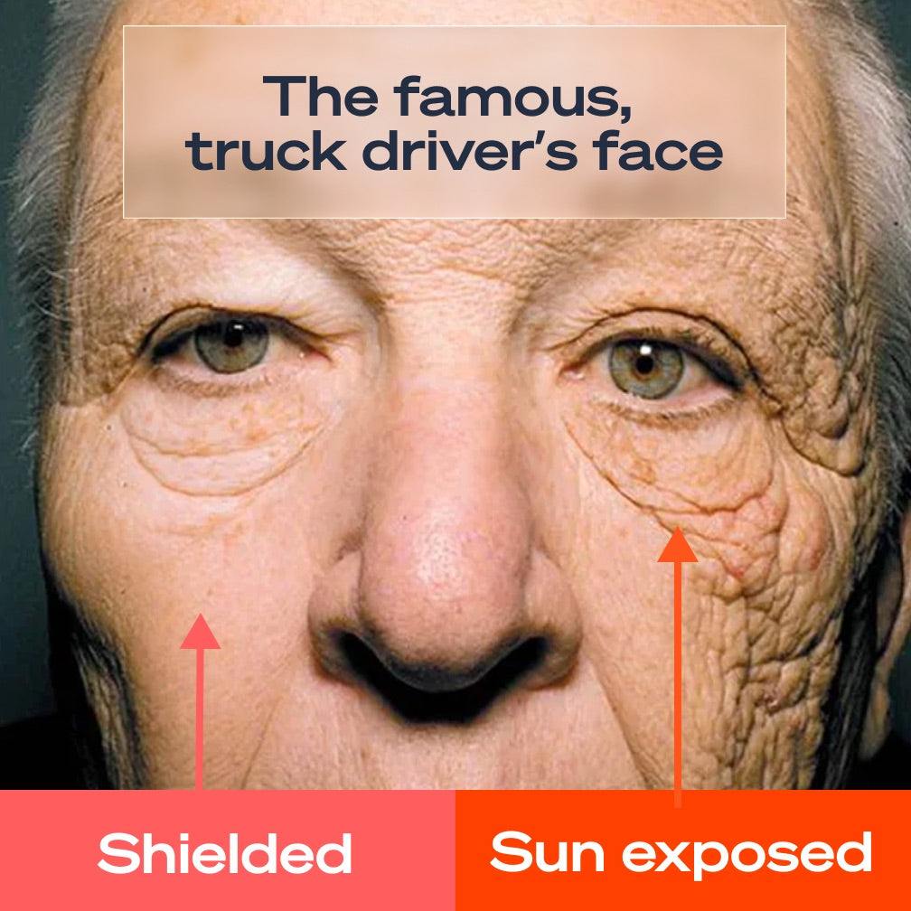 Truck driver's face showing shielded versus sun-exposed sides