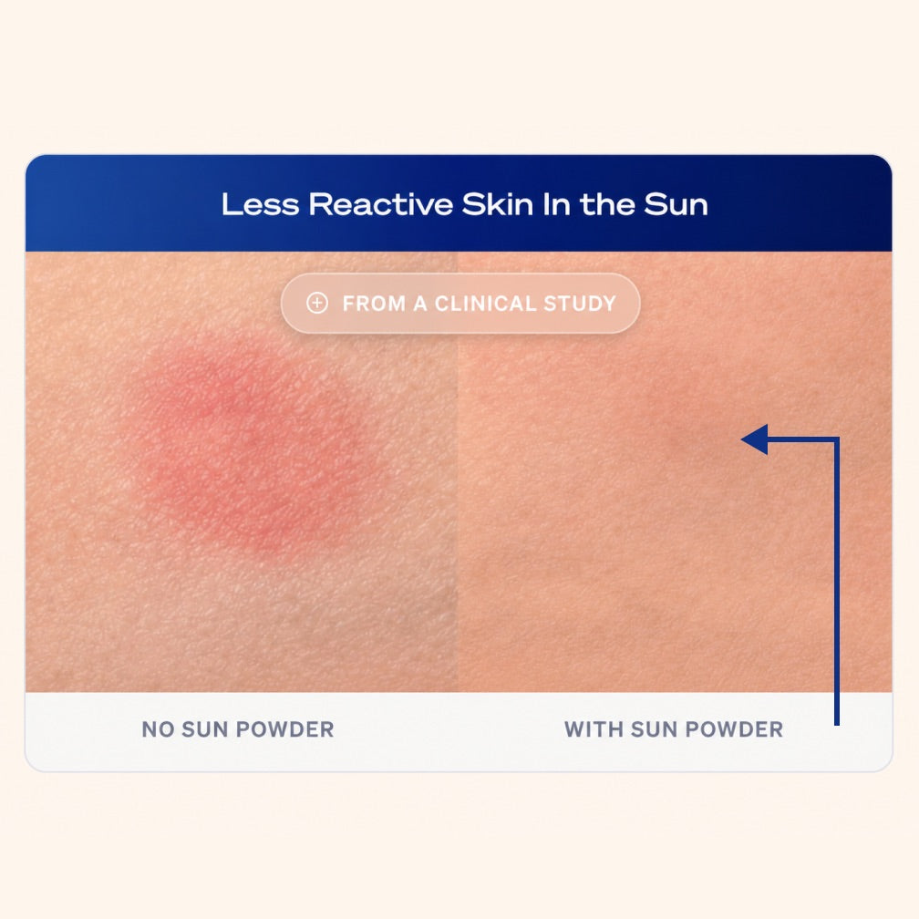 Less Reactive Skin in the Sun: clinical study showing reduced redness with Sun Powder