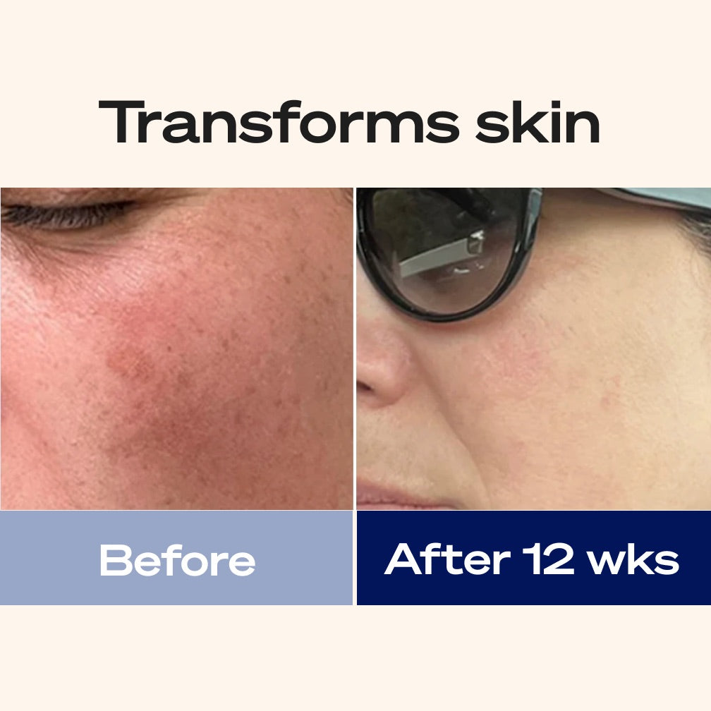 Transforms skin: before and after 12 weeks of Sun Powder